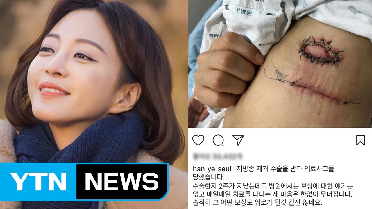 韓国女優　皮膚科　火傷事故